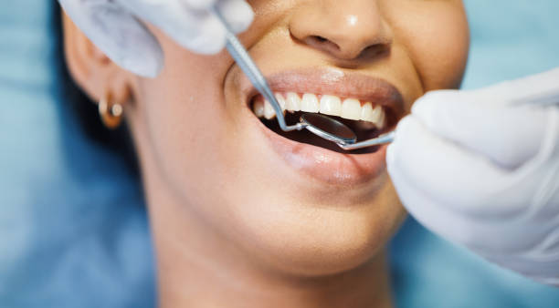 Best Emergency Wisdom Teeth Removal in North Pole, AK